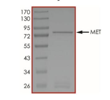 The specific activity of MET (Del Ex14) was determinged to be 38 nmol/min/mg as per activity assay protocol.